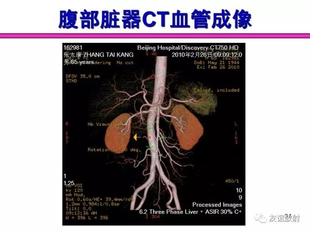 影像PPT - 【PPT】腹部脏器影像解剖及CT、MRI读片原则-34