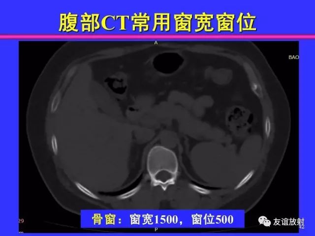 影像PPT - 【PPT】腹部脏器影像解剖及CT、MRI读片原则-42
