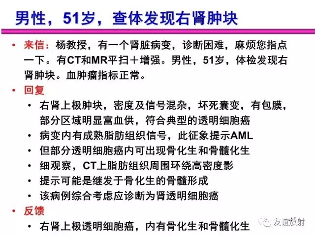 影像PPT - 【PPT】腹部脏器影像解剖及CT、MRI读片原则-45