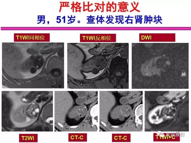 影像PPT - 【PPT】腹部脏器影像解剖及CT、MRI读片原则-46