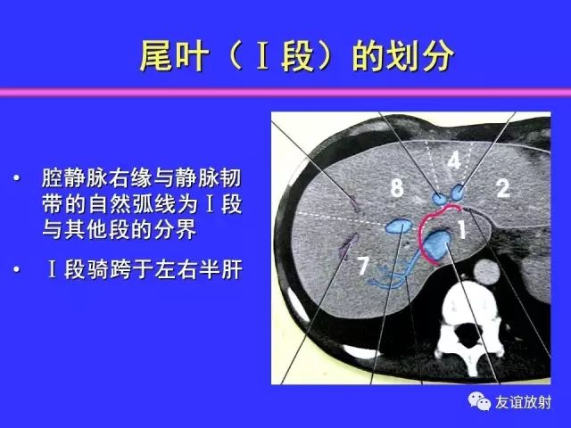 影像PPT - 【PPT】腹部脏器影像解剖及CT、MRI读片原则-63
