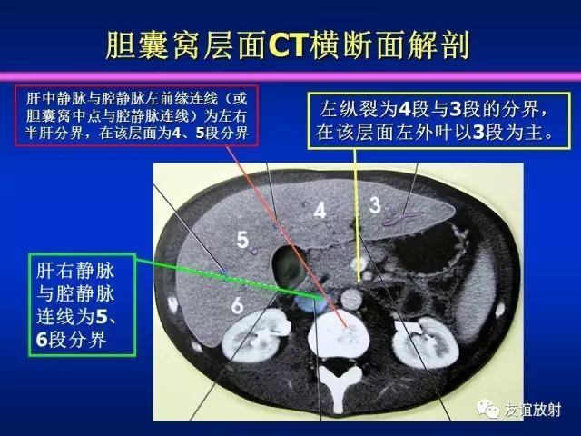 影像PPT - 【PPT】腹部脏器影像解剖及CT、MRI读片原则-72