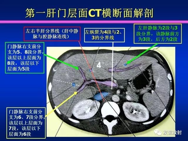 影像PPT - 【PPT】腹部脏器影像解剖及CT、MRI读片原则-71
