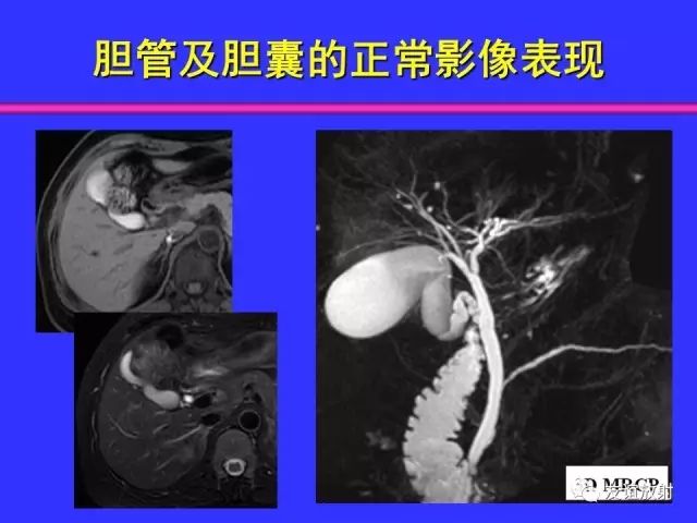 影像PPT - 【PPT】腹部脏器影像解剖及CT、MRI读片原则-77
