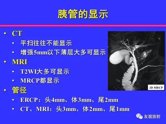 影像PPT - 【PPT】腹部脏器影像解剖及CT、MRI读片原则-82