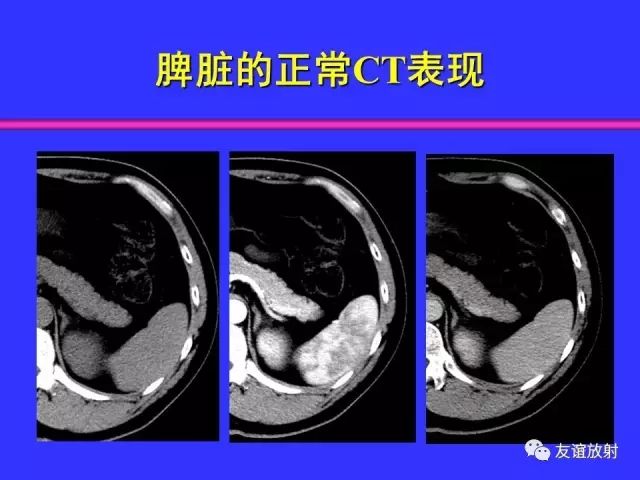 影像PPT - 【PPT】腹部脏器影像解剖及CT、MRI读片原则-88