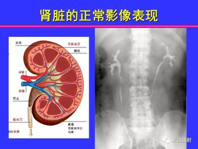 影像PPT - 【PPT】腹部脏器影像解剖及CT、MRI读片原则-91