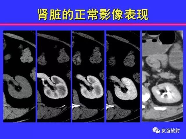 影像PPT - 【PPT】腹部脏器影像解剖及CT、MRI读片原则-93