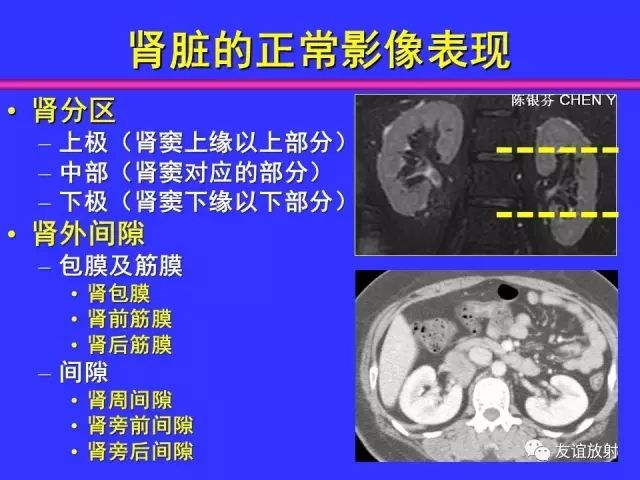 影像PPT - 【PPT】腹部脏器影像解剖及CT、MRI读片原则-95