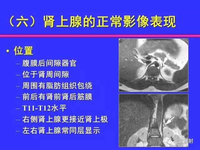 影像PPT - 【PPT】腹部脏器影像解剖及CT、MRI读片原则-98
