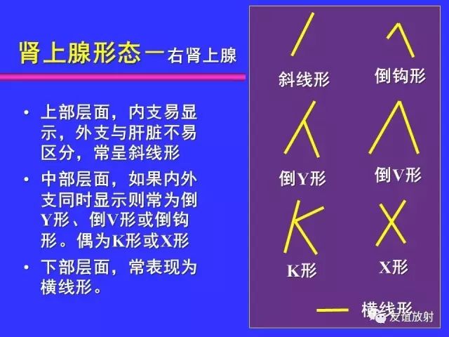 影像PPT - 【PPT】腹部脏器影像解剖及CT、MRI读片原则-102