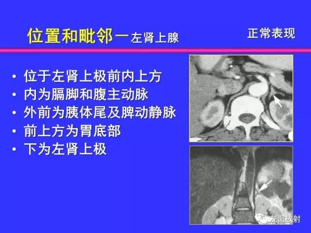 影像PPT - 【PPT】腹部脏器影像解剖及CT、MRI读片原则-100
