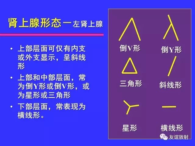 影像PPT - 【PPT】腹部脏器影像解剖及CT、MRI读片原则-103