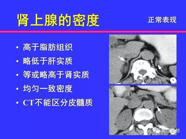 影像PPT - 【PPT】腹部脏器影像解剖及CT、MRI读片原则-107