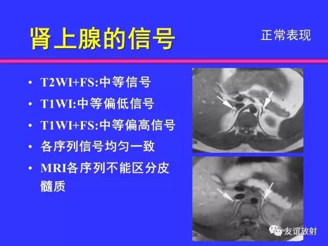 影像PPT - 【PPT】腹部脏器影像解剖及CT、MRI读片原则-108