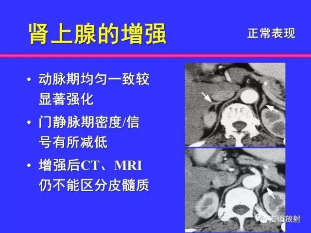 影像PPT - 【PPT】腹部脏器影像解剖及CT、MRI读片原则-109