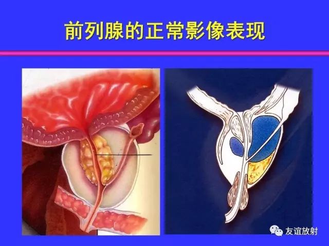 影像PPT - 【PPT】腹部脏器影像解剖及CT、MRI读片原则-117