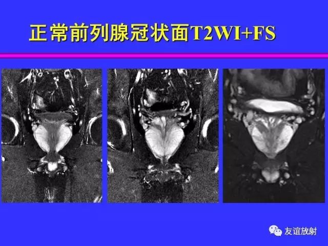 影像PPT - 【PPT】腹部脏器影像解剖及CT、MRI读片原则-120