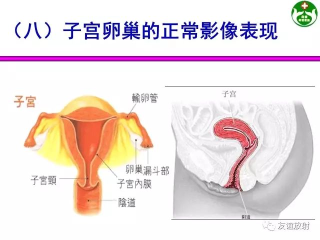影像PPT - 【PPT】腹部脏器影像解剖及CT、MRI读片原则-123