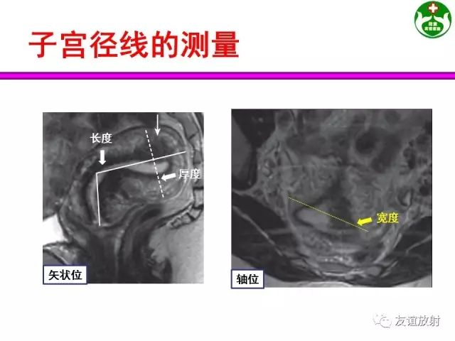 影像PPT - 【PPT】腹部脏器影像解剖及CT、MRI读片原则-125