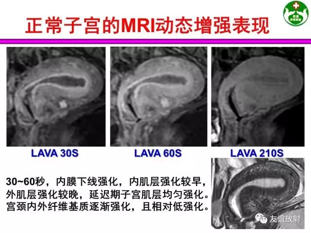 影像PPT - 【PPT】腹部脏器影像解剖及CT、MRI读片原则-130