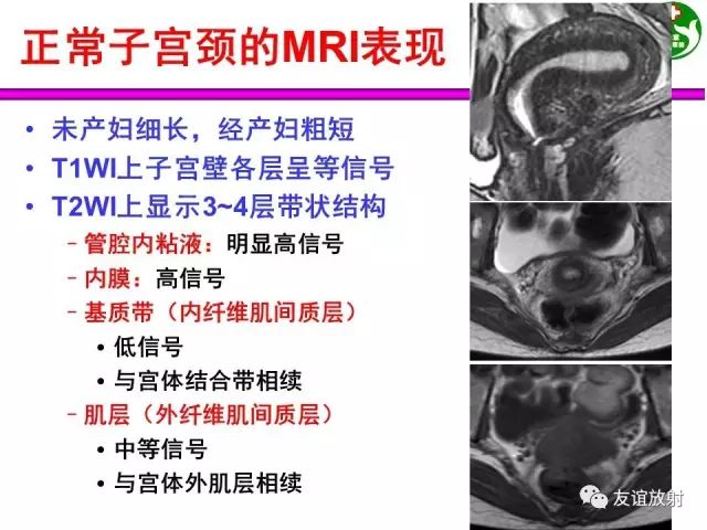 影像PPT - 【PPT】腹部脏器影像解剖及CT、MRI读片原则-128