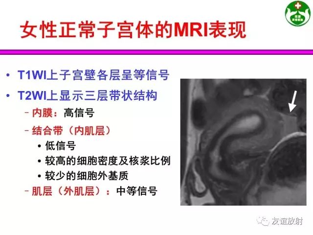 影像PPT - 【PPT】腹部脏器影像解剖及CT、MRI读片原则-127