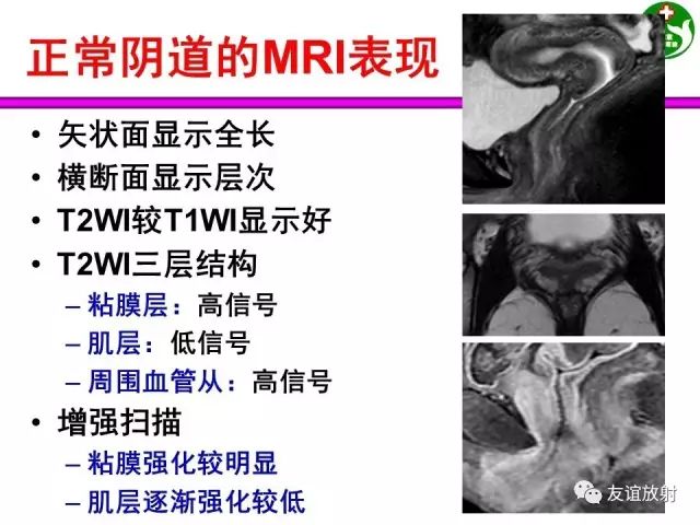 影像PPT - 【PPT】腹部脏器影像解剖及CT、MRI读片原则-131