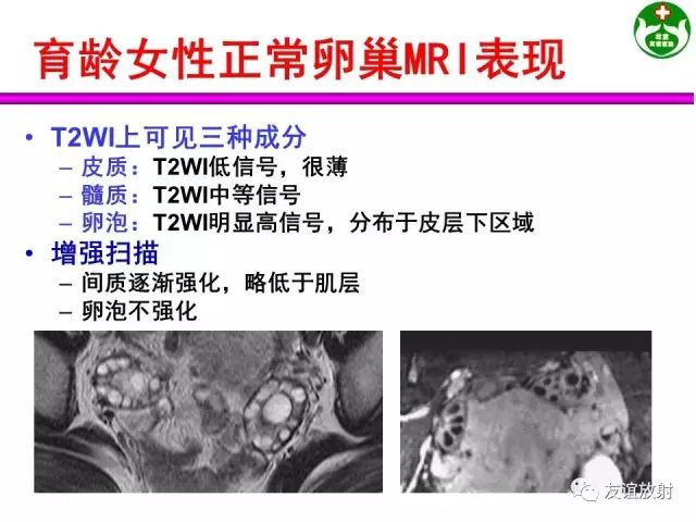 影像PPT - 【PPT】腹部脏器影像解剖及CT、MRI读片原则-133