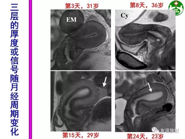 影像PPT - 【PPT】腹部脏器影像解剖及CT、MRI读片原则-136