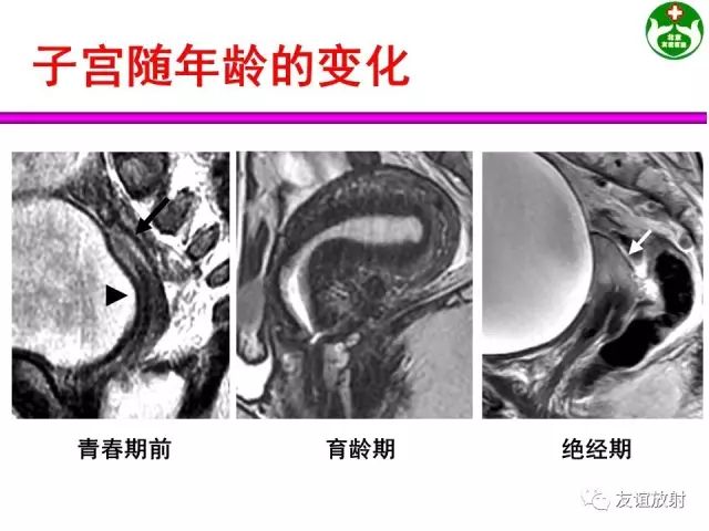 影像PPT - 【PPT】腹部脏器影像解剖及CT、MRI读片原则-139