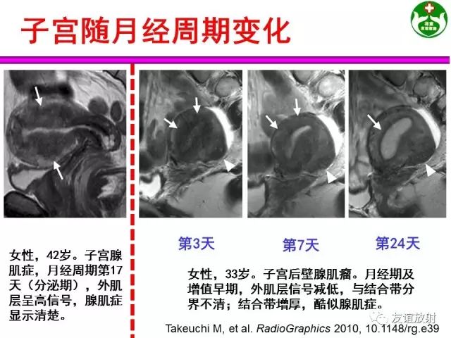 影像PPT - 【PPT】腹部脏器影像解剖及CT、MRI读片原则-141