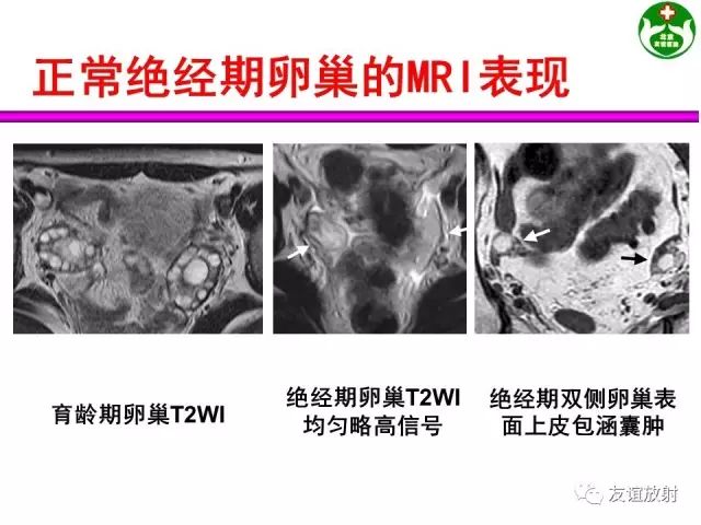 影像PPT - 【PPT】腹部脏器影像解剖及CT、MRI读片原则-140