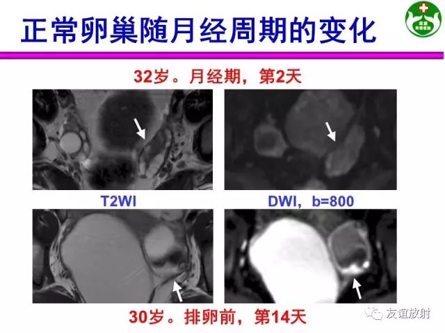 影像PPT - 【PPT】腹部脏器影像解剖及CT、MRI读片原则-143