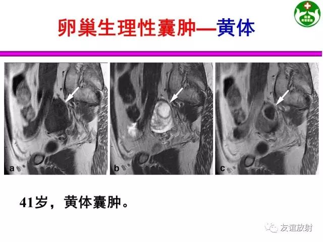 影像PPT - 【PPT】腹部脏器影像解剖及CT、MRI读片原则-148