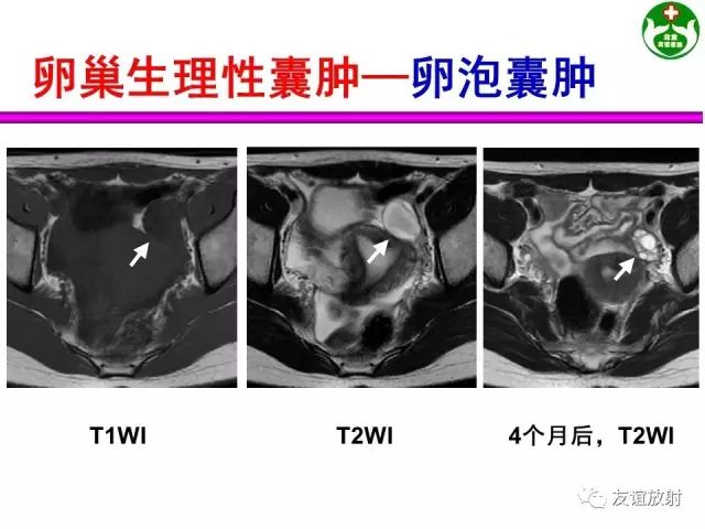 影像PPT - 【PPT】腹部脏器影像解剖及CT、MRI读片原则-146