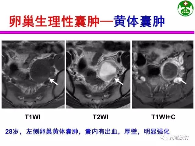 影像PPT - 【PPT】腹部脏器影像解剖及CT、MRI读片原则-147