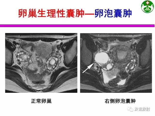 影像PPT - 【PPT】腹部脏器影像解剖及CT、MRI读片原则-145