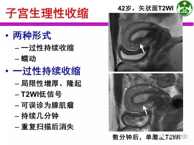 影像PPT - 【PPT】腹部脏器影像解剖及CT、MRI读片原则-151
