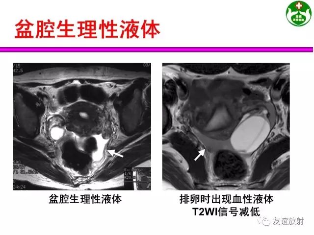 影像PPT - 【PPT】腹部脏器影像解剖及CT、MRI读片原则-150