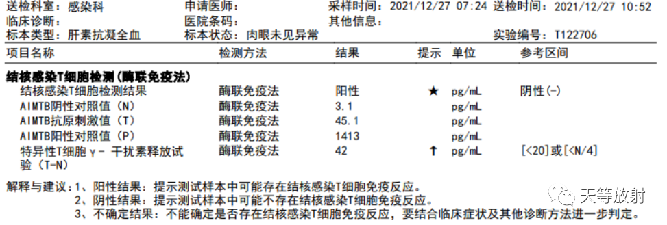 影像PPT - 【病例】肺结核典型CT病例分析-9 影像PPT - 【病例】肺结核典型CT病例分析-9