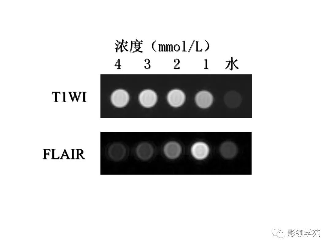 影像PPT - 【PPT】头颅T2-Flair增强扫描的意义及临床应用-5 影像PPT - 【PPT】头颅T2-Flair增强扫描的意义及临床应用-5