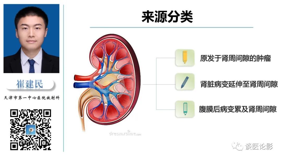 影像PPT - 【PPT】肾周间隙肿瘤性病变影像表现-4 影像PPT - 【PPT】肾周间隙肿瘤性病变影像表现-4