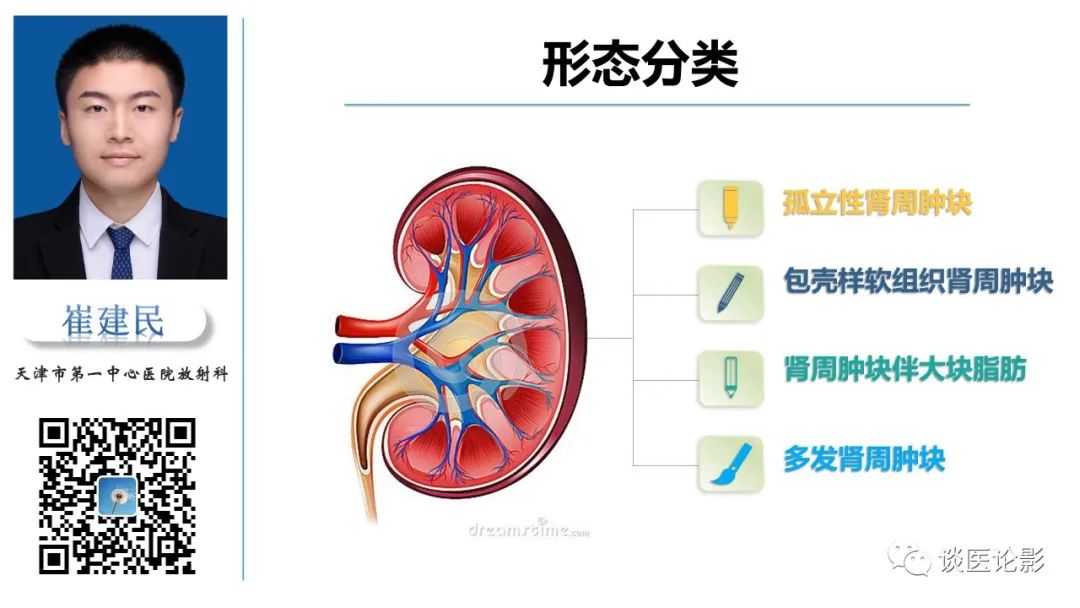 影像PPT - 【PPT】肾周间隙肿瘤性病变影像表现-6 影像PPT - 【PPT】肾周间隙肿瘤性病变影像表现-6