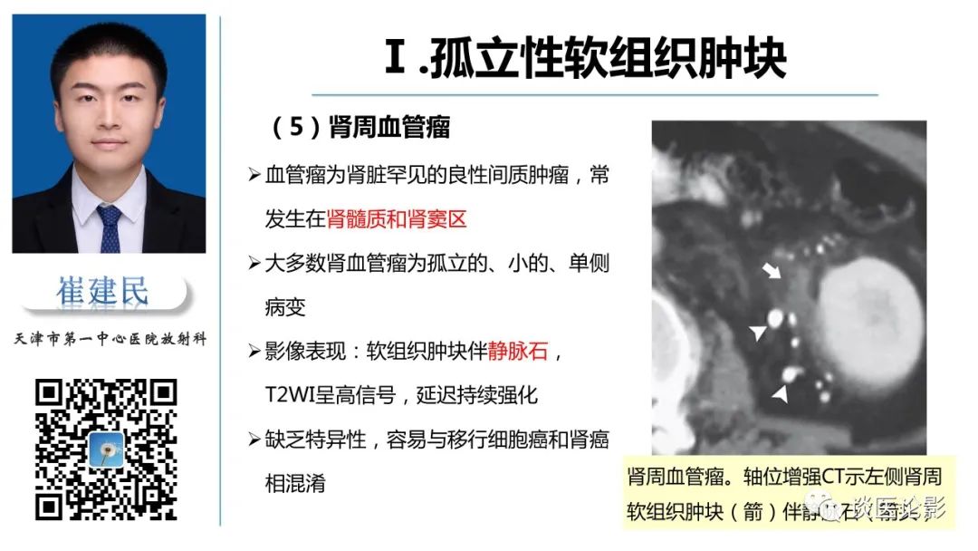影像PPT - 【PPT】肾周间隙肿瘤性病变影像表现-16 影像PPT - 【PPT】肾周间隙肿瘤性病变影像表现-16