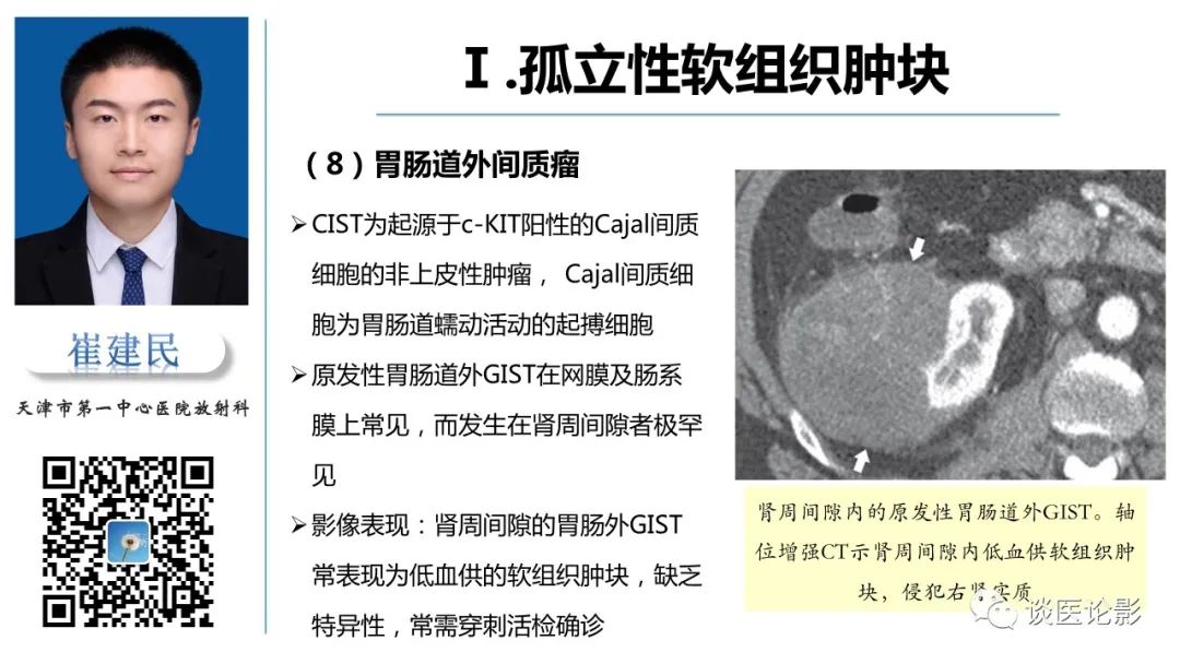 影像PPT - 【PPT】肾周间隙肿瘤性病变影像表现-20 影像PPT - 【PPT】肾周间隙肿瘤性病变影像表现-20