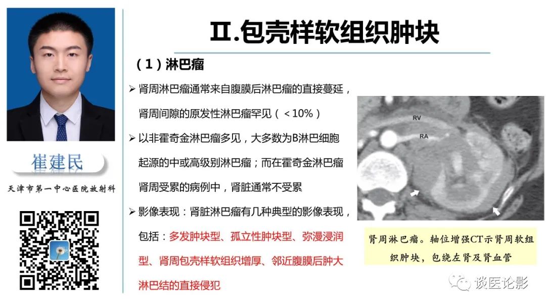 影像PPT - 【PPT】肾周间隙肿瘤性病变影像表现-22 影像PPT - 【PPT】肾周间隙肿瘤性病变影像表现-22