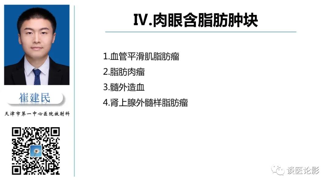 影像PPT - 【PPT】肾周间隙肿瘤性病变影像表现-32 影像PPT - 【PPT】肾周间隙肿瘤性病变影像表现-32