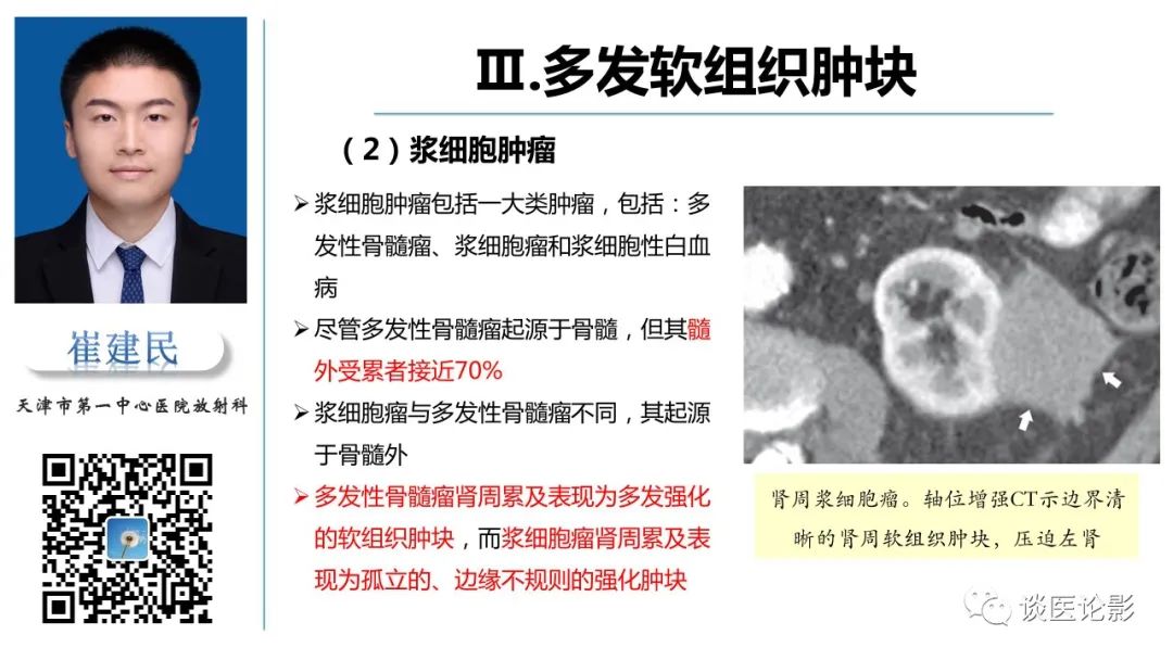 影像PPT - 【PPT】肾周间隙肿瘤性病变影像表现-31 影像PPT - 【PPT】肾周间隙肿瘤性病变影像表现-31
