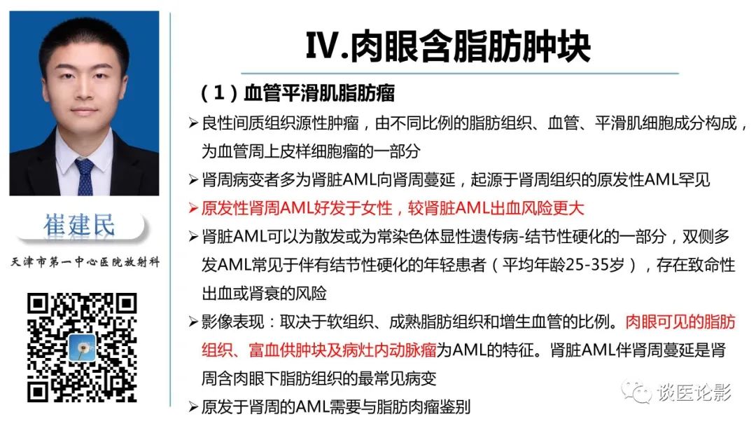 影像PPT - 【PPT】肾周间隙肿瘤性病变影像表现-33 影像PPT - 【PPT】肾周间隙肿瘤性病变影像表现-33